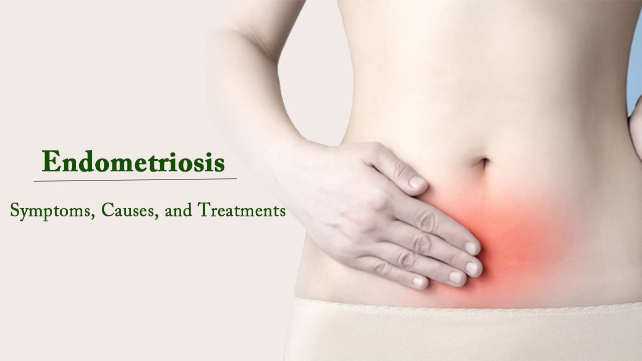 endometriosis Treatment