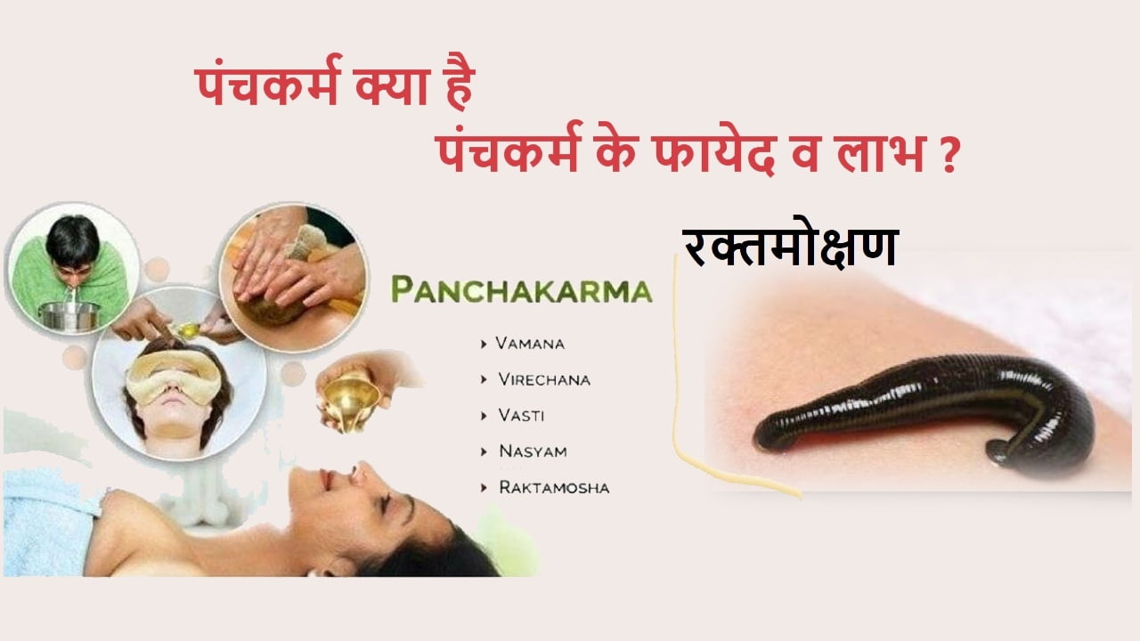 рд░рдХреНрддрдореЛрдХреНрд╖рдг (Blood-Letting)