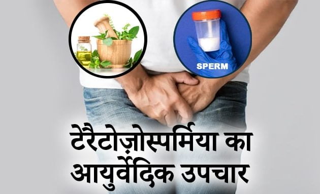 टेरैटोज़ोस्पर्मिया, Teratozoospermia का आयुर्वेदिक उपचार