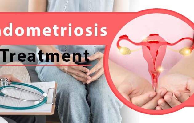 Endometriosis Ayurvedic Treatment in Hindi