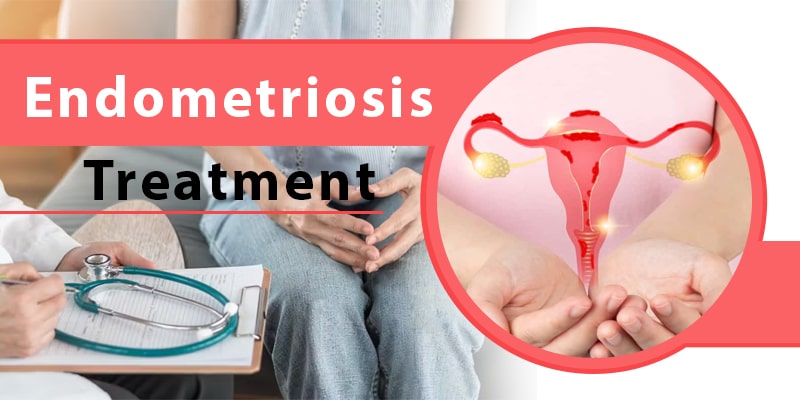 Endometriosis Ayurvedic Treatment in Hindi