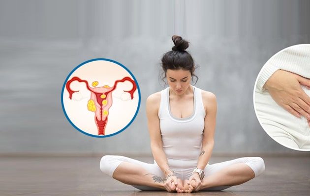 yoga for Fibroid, Fibroid control by Yoga