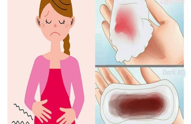 Stop Heavy Bleeding During Periods