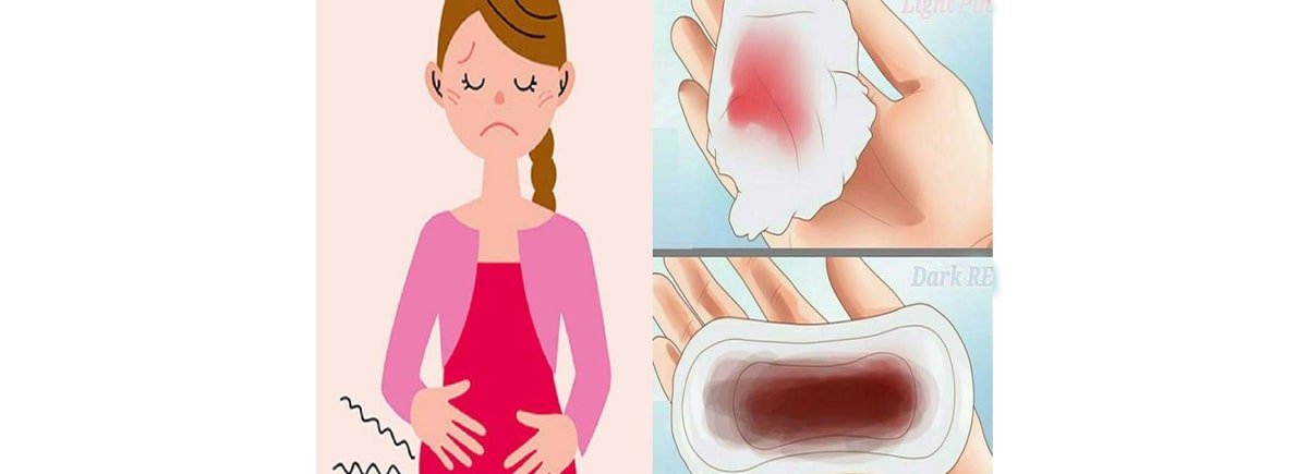 Stop Heavy Bleeding During Periods