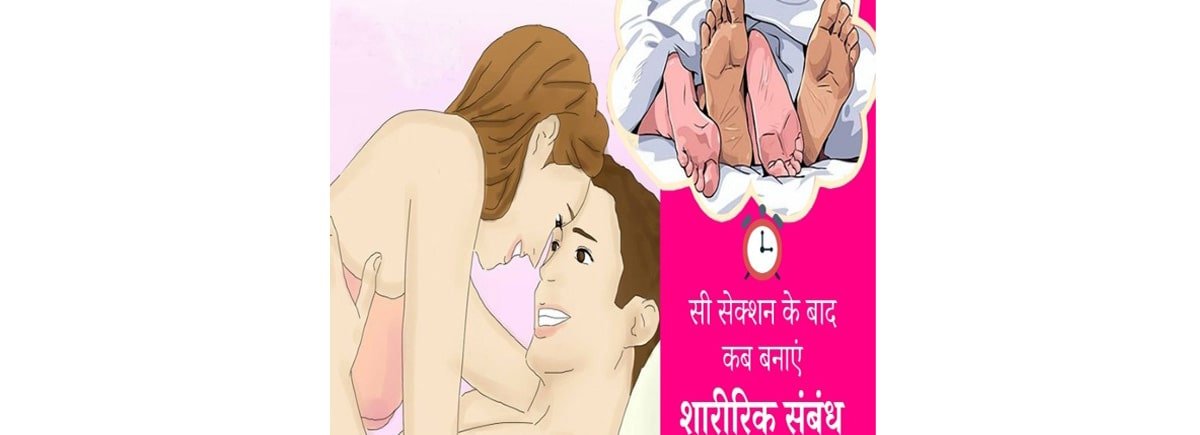 सिजेरियन डिलीवरी के बाद कब संबंध बनाना चाहिए?,