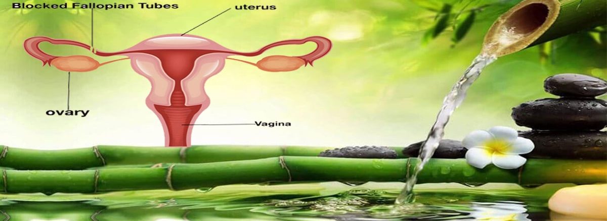 blocked fallopian tube, tubal blockage treatment