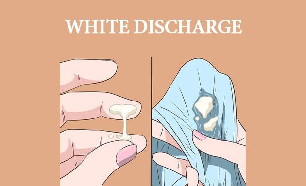 white discharge in hindi