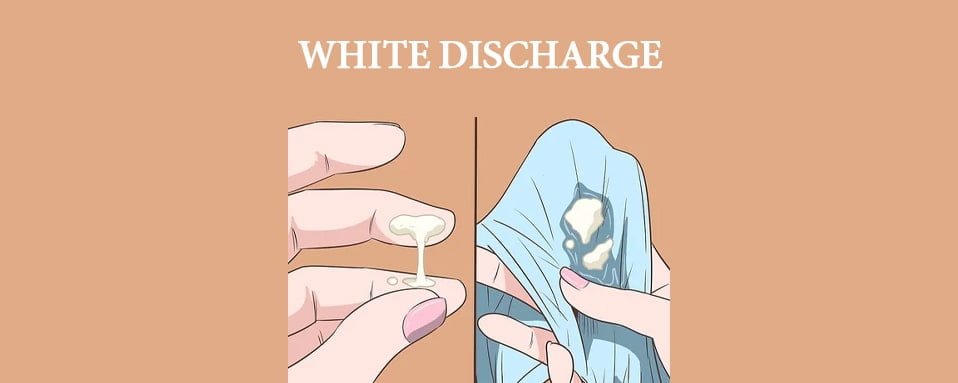 white discharge in hindi