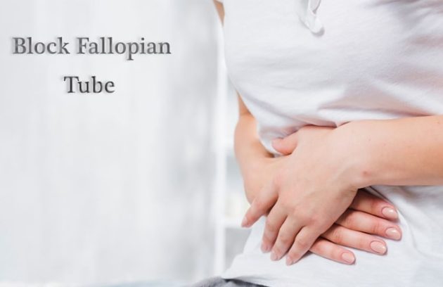 block fallopain tube, tubal blockage