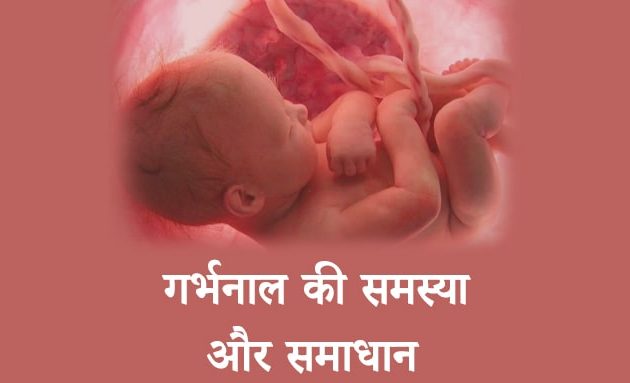 गर्भनाल की समस्या और समाधान,umbilical cord in hindi