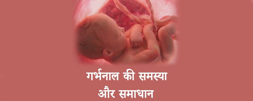 गर्भनाल की समस्या और समाधान,umbilical cord in hindi