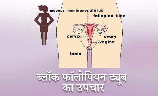 fallopian tube treatment, block fallopain tube ka ilaj