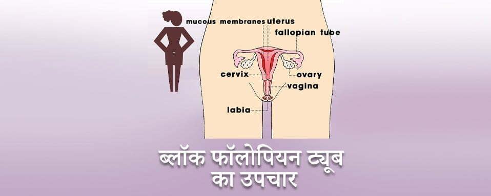 fallopian tube treatment, block fallopain tube ka ilaj