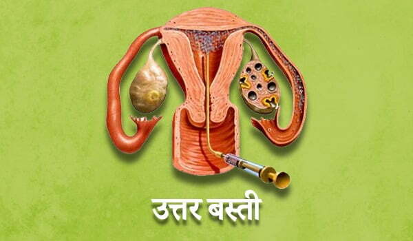 फैलोपियन ट्यूब को खोलने के लिए उत्तर बस्ती, Uttar basti for open blocked fallopian tubes