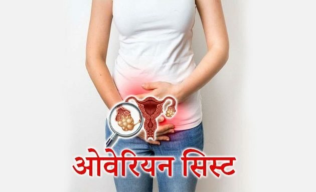 ovarian cyst in hindi, dr chanchal sharma