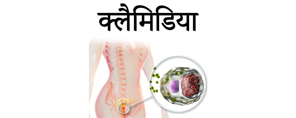 Chlamydia, क्लैमिडिया के लक्षण, क्लैमाइडिया क्या है