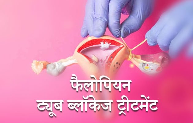 फैलोपियन ट्यूब ब्लॉकेज ट्रीटमेंट, Tubal Blockage Treatment in Hindi