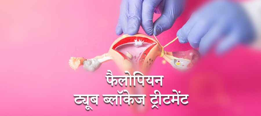 फैलोपियन ट्यूब ब्लॉकेज ट्रीटमेंट, Tubal Blockage Treatment in Hindi