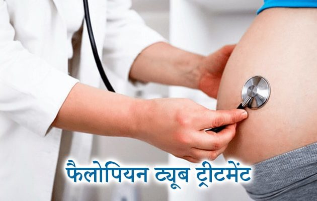 फैलोपियन ट्यूब ट्रीटमेंट, Fallopian tube treatment