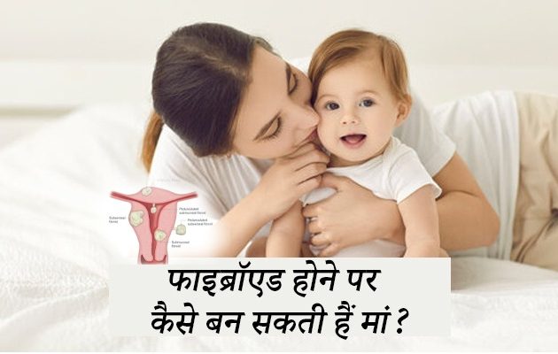 बच्‍चेदानी में रसौली, fibroids in hindi
