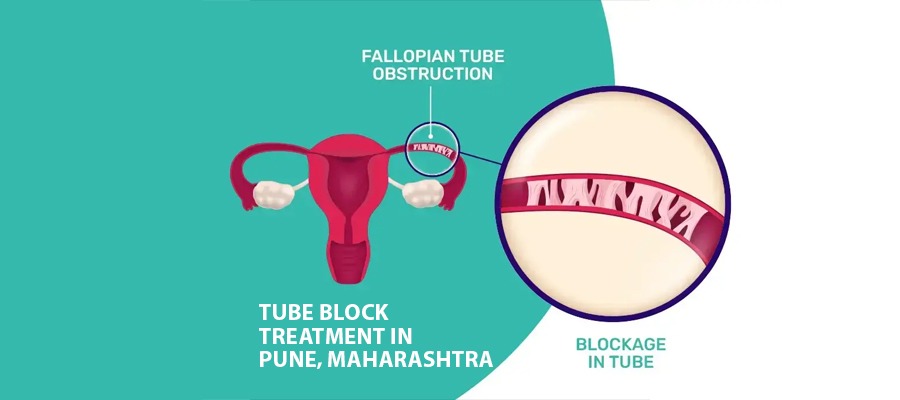 Tube Block Treatment in Pune, Maharashtra